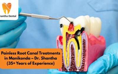 Painless Root Canal Treatment in Manikonda | Dr. Shantha | 35+ Years of Expertise
