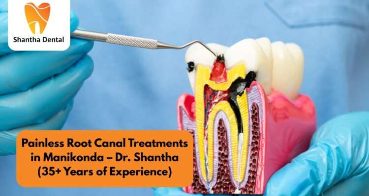 Painless Root Canal Treatment in Manikonda | Dr. Shantha | 35+ Years of Expertise
