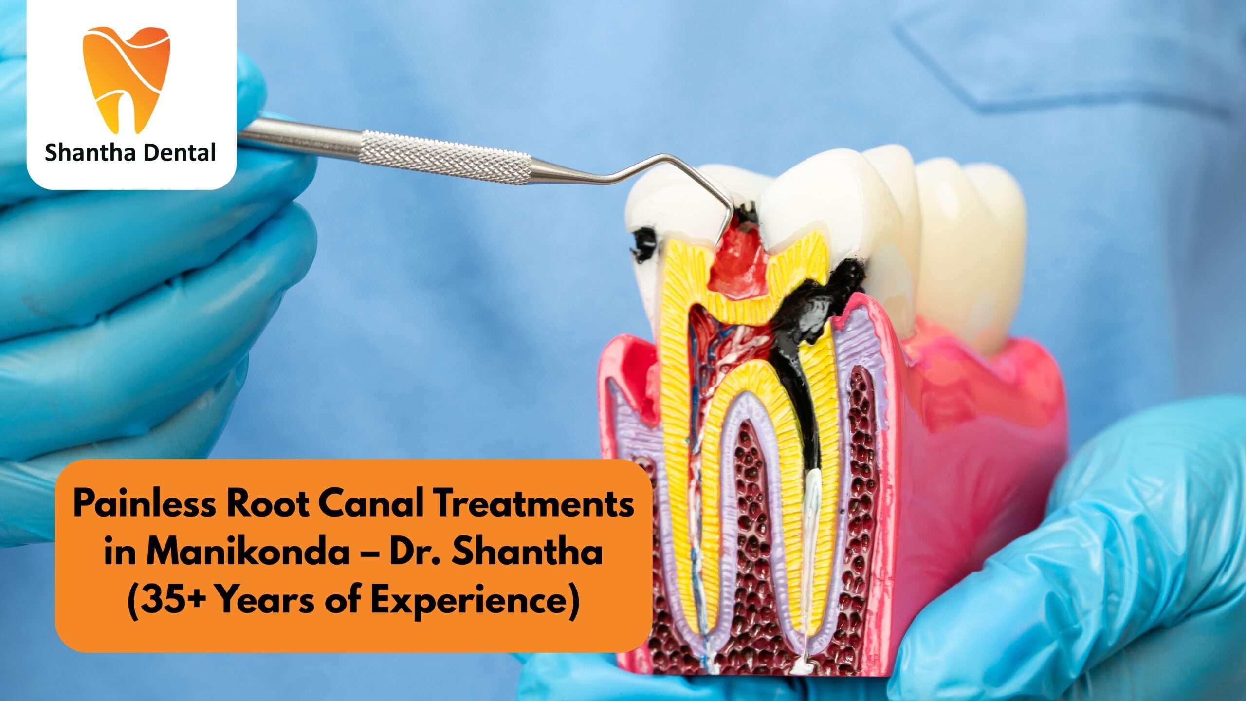 Painless Root Canal Treatment in Manikonda | Dr. Shantha | 35+ Years of Expertise
