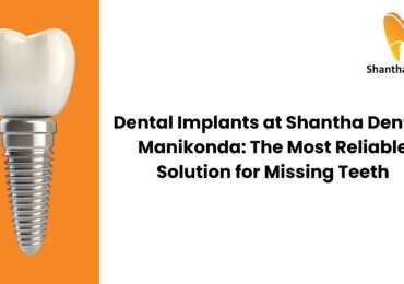Dental Implants in Manikonda | Reliable Tooth Replacement at Shantha Dental