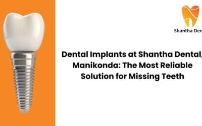 Dental Implants in Manikonda | Reliable Tooth Replacement at Shantha Dental