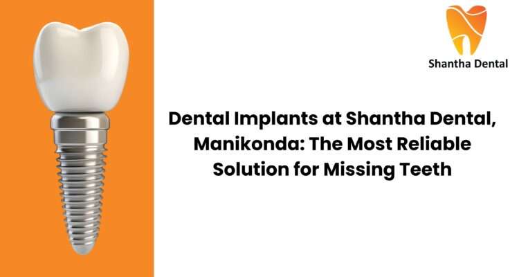 Dental Implants in Manikonda | Reliable Tooth Replacement at Shantha Dental
