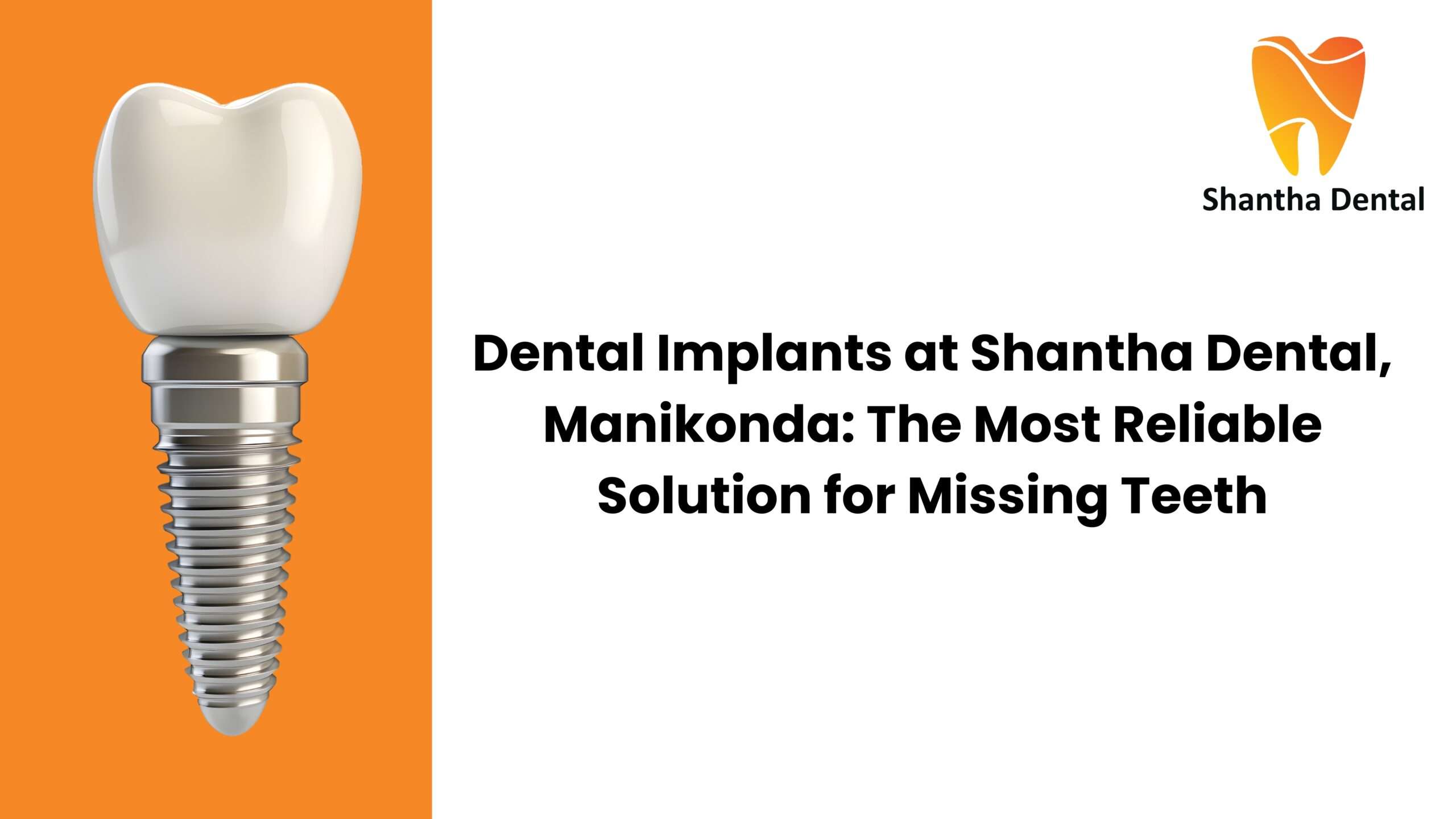 Dental Implants in Manikonda | Reliable Tooth Replacement at Shantha Dental
